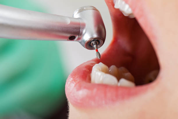 Best Emergency Gum Treatment in Brownsville, PA